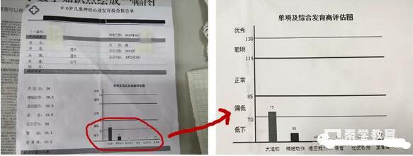 妇幼保健院高危儿门诊的四岁孩子告诉爸爸妈妈应该帮助孩子发育智力